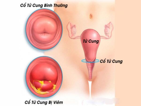 Jak vyléčit bolestivé močení doma pomocí orientální medicíny