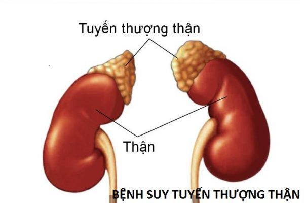 Addisonova nemoc: Příčiny, příznaky a léčba