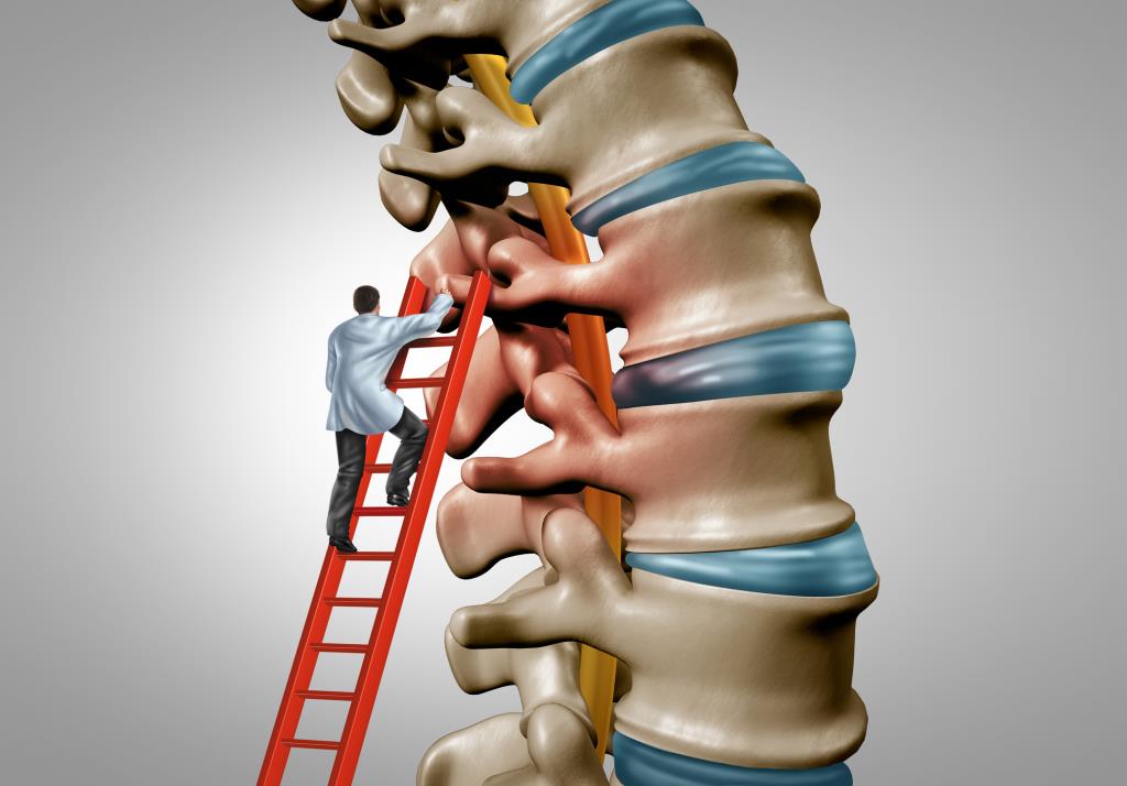 Spinální stenóza: diagnostika a léčba