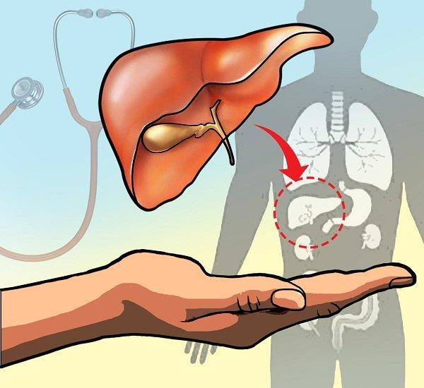 Hepatopulmonální syndrom: Definice, příznaky, diagnostika a léčba