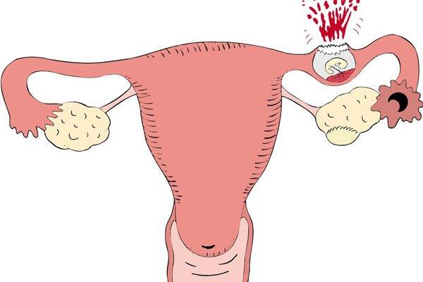 Bolesti břicha, na co si dát pozor, abychom nepřehlédli nebezpečné příčiny?