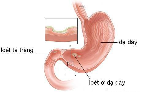 Kde se nachází epigastrium?  Proč je to důležité?