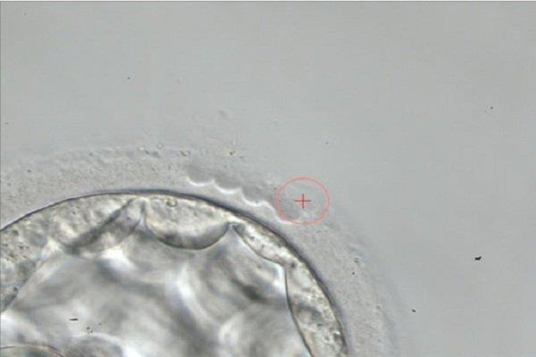 Nejoblíbenější metody asistované reprodukce současnosti