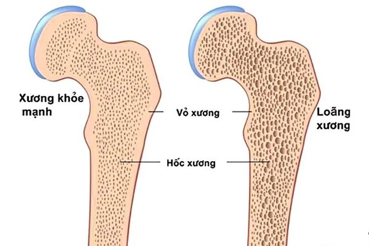 9 časných příznaků perimenopauzy, které potřebujete vědět?