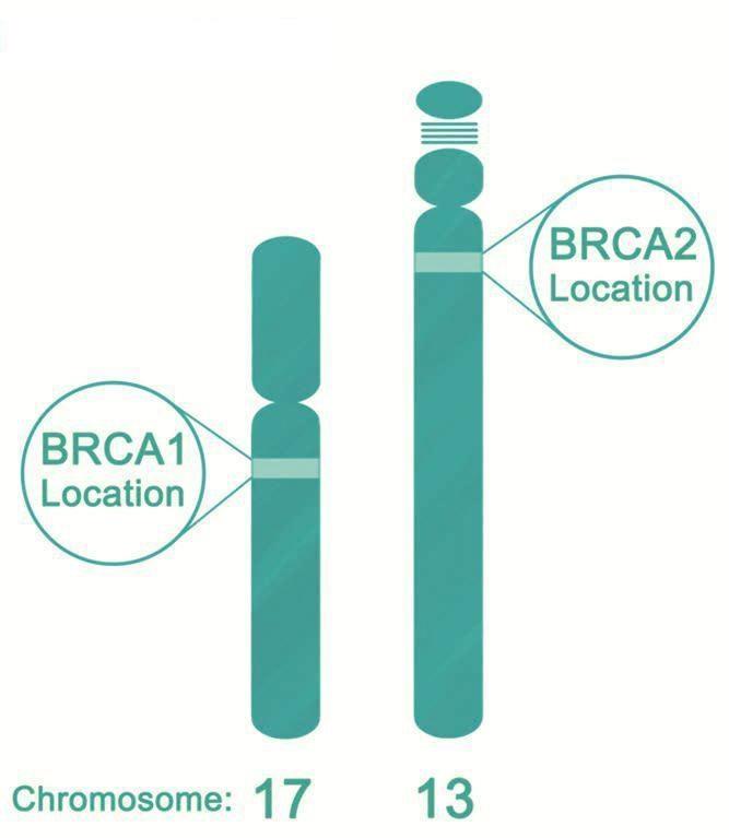 Gen BRCA a riziko rakoviny prsu a dalších orgánů