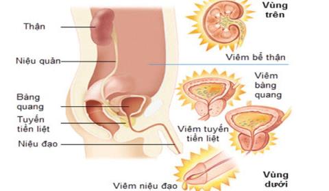 Všimněte si při užívání léků k léčbě uretritidy u mužů